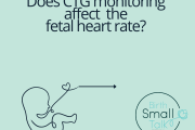 Does CTG monitoring affect the heart rate?