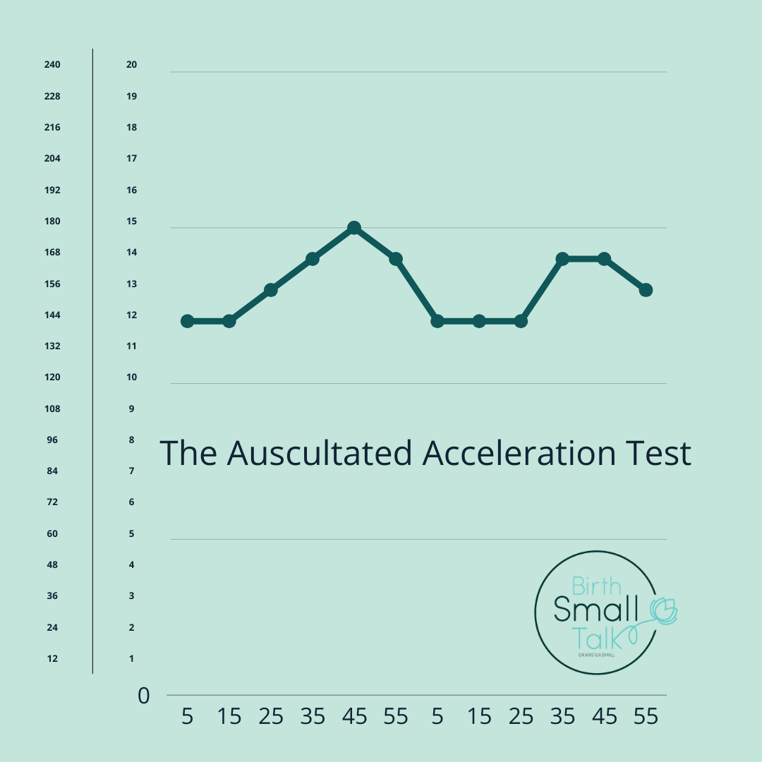 Accelertation Testing What is the Auscultated Acceleration Test? – Birth Small Talk